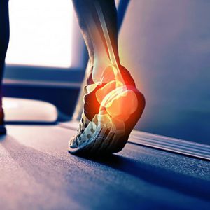 plantar